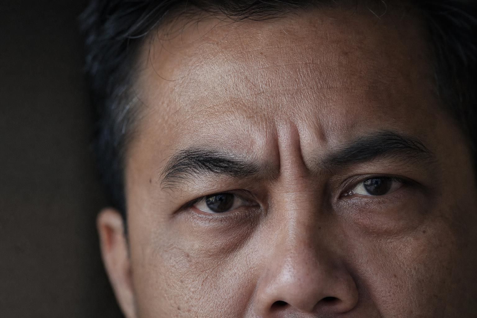 Illustrative example of Glabella (frown lines) on the male face