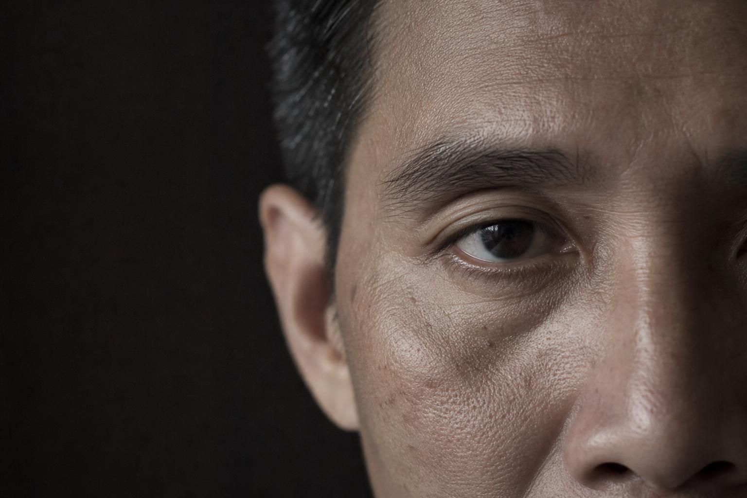 Illustrative example of Under-eye hollow on the male face
