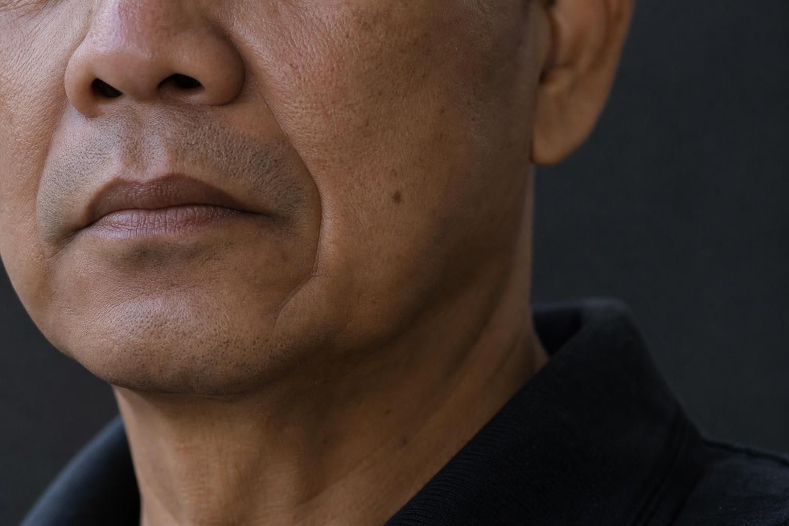Illustrative example of Marionette lines on the male face