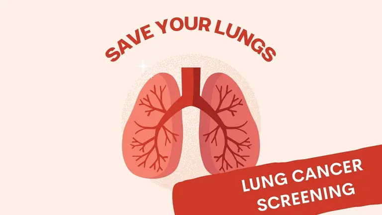 Low-dose CT lung cancer screening scan reviewed at a Singapore clinic