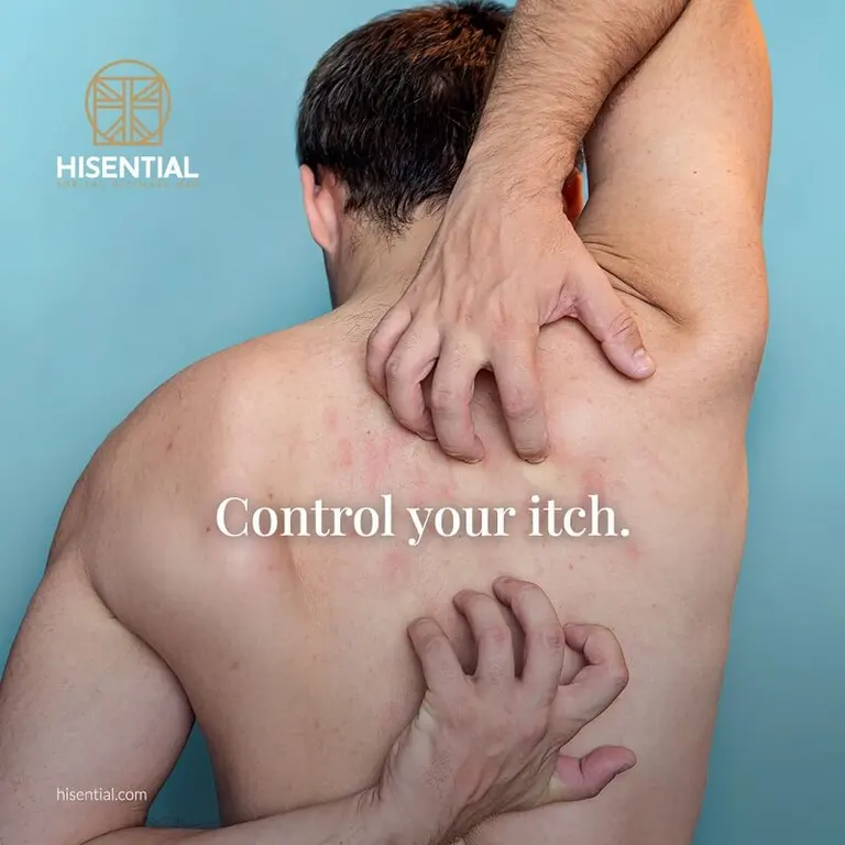 Food Allergy Testing | Hisential Men's Health Clinic
