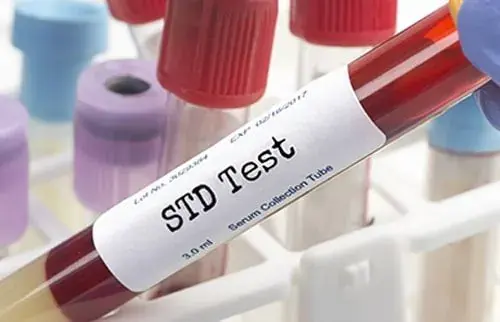 Anonymous STI and STD testing sample in Singapore